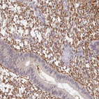 Immunohistochemical staining of human endometrium shows strong cytoplasmic positivity in stromal cells.