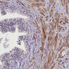 Immunohistochemical staining of human prostate shows strong cytoplasmic positivity in smooth muscle cells.