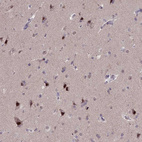 Immunohistochemical staining of human cerebral cortex shows strong nuclear positivity in neurons.