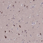 Immunohistochemical staining of human cerebral cortex shows strong nuclear positivity in neurons.