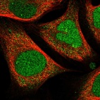 Immunofluorescent staining of human cell line U-2 OS shows localization to nucleus, nucleoli & cytosol.