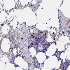 Immunohistochemical staining of human bone marrow shows strong cytoplasmic positivity in hematopoietic cells.