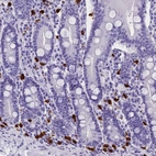 Immunohistochemical staining of human duodenum shows strong cytoplasmic positivity in lymphoid cells.