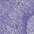 Anti-CLC Antibody