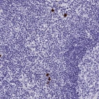 Immunohistochemical staining of human lymph node shows strong cytoplasmic positivity in a small subset of non-germinal center cells.