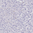 Immunohistochemical staining of human liver shows no positivity in hepatocytes as expected.