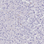 Anti-CLC Antibody