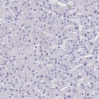 Immunohistochemical staining of human liver shows no positivity in hepatocytes as expected.