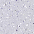 Immunohistochemical staining of human cerebral cortex shows no positivity in neurons as expected.