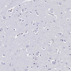 Anti-CLC Antibody