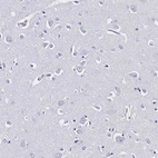 Immunohistochemical staining of human cerebral cortex shows no positivity in neurons as expected.