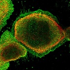Immunofluorescent staining of human cell line A-431 shows localization to nucleoplasm, plasma membrane & cytosol.