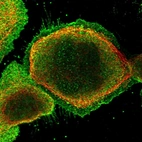 Immunofluorescent staining of human cell line A-431 shows localization to nucleoplasm, plasma membrane & cytosol.