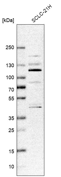 Anti-ZNF598 Antibody