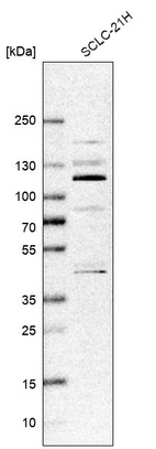 Anti-ZNF598 Antibody