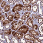 Anti-NRN1L Antibody