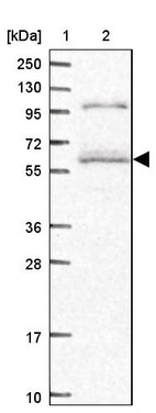 Lane 1: Marker [kDa] 250, 130, 95, 72, 55, 36, 28, 17, 10_br/_Lane 2: Human cell line RT-4