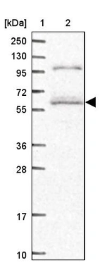 Lane 1: Marker [kDa] 250, 130, 95, 72, 55, 36, 28, 17, 10_br/_Lane 2: Human cell line RT-4