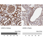 Anti-LDHD Antibody