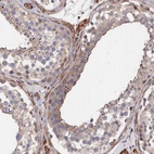 Immunohistochemical staining of human testis shows low expression as expected.