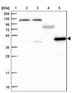Lane 1: Marker [kDa] 250, 130, 95, 72, 55, 36, 28, 17, 10_br/_Lane 2: Human cell line RT-4_br/_Lane 3: Human cell line U-251MG sp_br/_Lane 4: Human plasma (IgG/HSA depleted)_br/_Lane 5: Human liver tissue