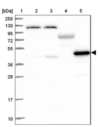 Lane 1: Marker [kDa] 250, 130, 95, 72, 55, 36, 28, 17, 10_br/_Lane 2: Human cell line RT-4_br/_Lane 3: Human cell line U-251MG sp_br/_Lane 4: Human plasma (IgG/HSA depleted)_br/_Lane 5: Human liver tissue
