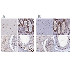 Immunohistochemical staining of human cerebral cortex, colon, kidney and testis using Anti-NOL4L antibody HPA041768 (A) shows similar protein distribution across tissues to independent antibody HPA043600 (B).
