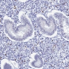 Immunohistochemical staining of human endometrium shows low expression as expected.