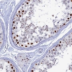 Immunohistochemical staining of human testis shows high expression.