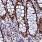Immunohistochemical staining of human colon using Anti-NOL4L antibody HPA041768.