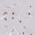 Immunohistochemical staining of human cerebral cortex using Anti-NOL4L antibody HPA041768.