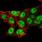 Immunofluorescent staining of human cell line Hep G2 shows localization to nucleoplasm.