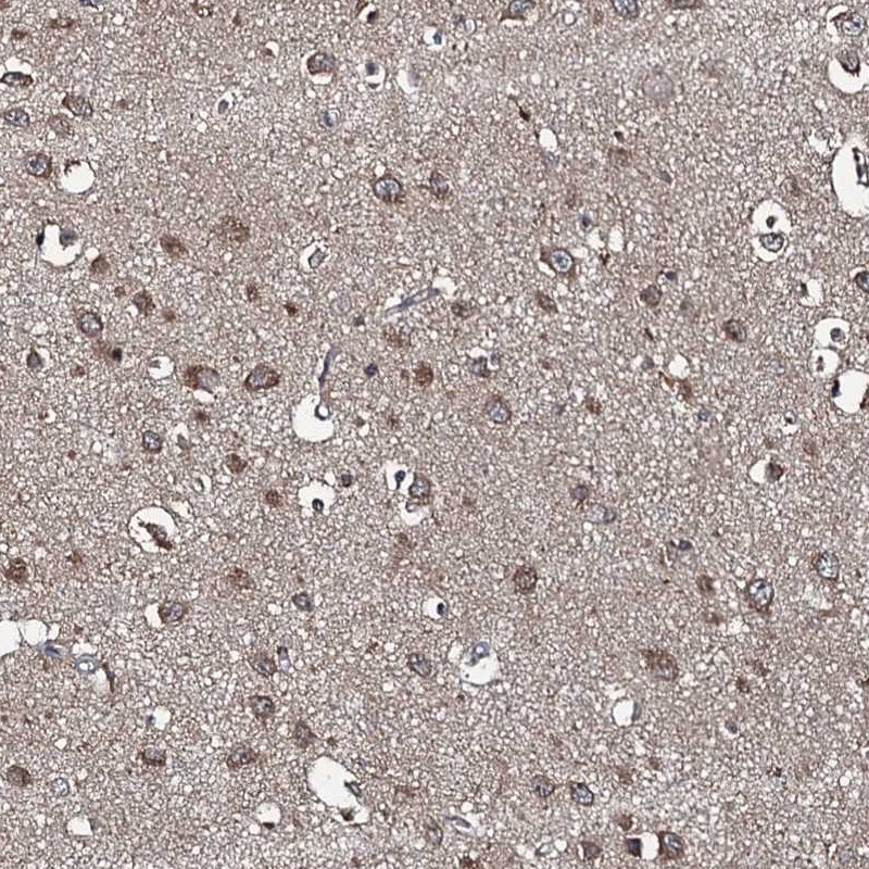 Anti-SNX32 Antibody