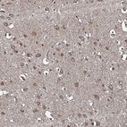 Anti-SNX32 Antibody