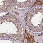 Anti-SLC38A7 Antibody