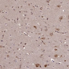 Immunohistochemical staining of human cerebral cortex shows moderate cytoplasmic positivity in neurons.