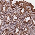 Immunohistochemical staining of human rectum shows strong cytoplasmic positivity in glandular cells.