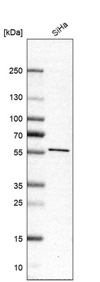 Anti-SLC38A7 Antibody