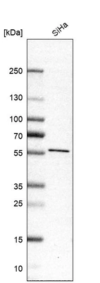 Western blot analysis in human cell line SiHa.