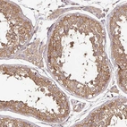Anti-MAPK8IP3 Antibody