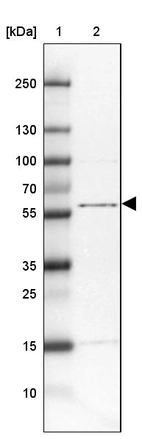 Lane 1: Marker [kDa] 250, 130, 100, 70, 55, 35, 25, 15, 10_br/_Lane 2: Human Tonsil tissue