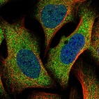 Immunofluorescent staining of human cell line U-2 OS shows localization to cytosol.