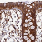 Immunohistochemical staining of human colon using Anti-TCF25 antibody HPA041786.