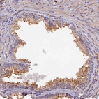 Immunohistochemical staining of human prostate shows moderate granular cytoplasmic positivity in glandular cells.