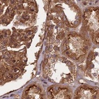 Immunohistochemical staining of human kidney using Anti-TCF25 antibody HPA041786.