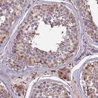 Immunohistochemical staining of human testis shows moderate granular cytoplasmic positivity in cells in seminiferous ducts and Leydig cells.