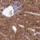 Immunohistochemical staining of human liver using Anti-TCF25 antibody HPA041786.
