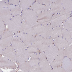 Immunohistochemical staining of human skeletal muscle shows no positivity in myocytes as expected.