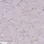 Immunohistochemical staining of human skeletal muscle shows no positivity in myocytes as expected.