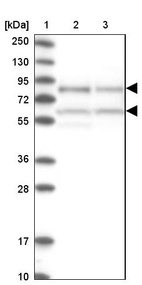 Lane 1: Marker [kDa] 250, 130, 95, 72, 55, 36, 28, 17, 10_br/_Lane 2: Human cell line RT-4_br/_Lane 3: Human cell line U-251MG sp